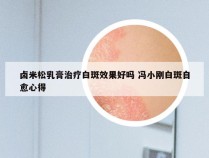 卤米松乳膏治疗白斑效果好吗 冯小刚白斑自愈心得