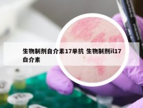 生物制剂自介素17单抗 生物制剂il17白介素