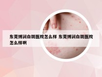 东莞博润白斑医院怎么样 东莞博润白斑医院怎么样啊