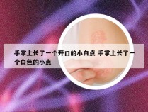 手掌上长了一个开口的小白点 手掌上长了一个白色的小点