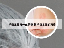 手藓足藓用什么药膏 擦手藓足藓的药膏