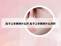 肚子上长癣用什么药 肚子上长癣用什么药好