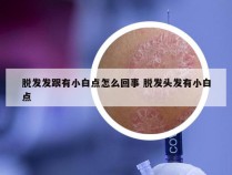 脱发发跟有小白点怎么回事 脱发头发有小白点