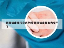 银屑病皮损压之退色吗 银屑病皮损变大变平了