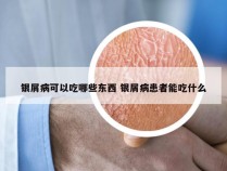 银屑病可以吃哪些东西 银屑病患者能吃什么