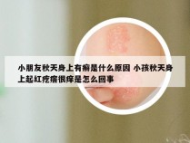 小朋友秋天身上有癣是什么原因 小孩秋天身上起红疙瘩很痒是怎么回事