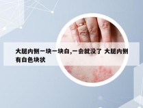 大腿内侧一块一块白,一会就没了 大腿内侧有白色块状