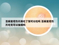 百癣夏塔热片刚吃了饭可以吃吗 百癣夏塔热片吃完可以抽烟吗