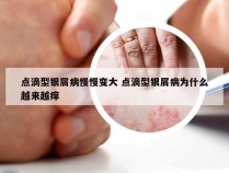 点滴型银屑病慢慢变大 点滴型银屑病为什么越来越痒