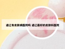 通辽有皮肤病医院吗 通辽最好的皮肤科医院