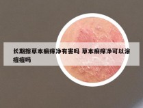 长期擦草本癣痒净有害吗 草本癣痒净可以涂痘痘吗