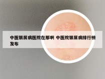 中医银屑病医院在那啊 中医院银屑病排行榜发布