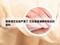 银屑病艾灸后严重了 艾灸银屑病刚开始会厉害吗