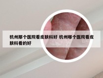 杭州那个医院看皮肤科好 杭州哪个医院看皮肤科看的好