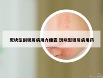 斑块型副银屑病用力康霜 斑块型银屑病用药