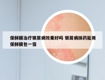 保鲜膜治疗银屑病效果好吗 银屑病抹药能用保鲜膜包一宿