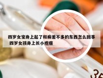 四岁女宝身上起了和癣差不多的东西怎么回事 四岁女孩身上长小疙瘩