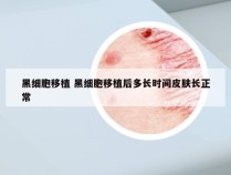 黑细胞移植 黑细胞移植后多长时间皮肤长正常