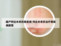 国产阿达木单抗银屑病 阿达木单抗治疗银屑病原理