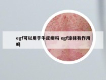 egf可以用于牛皮癣吗 egf涂抹有作用吗