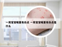 一周宝宝嘴里有白点 一周宝宝嘴里有白点是什么