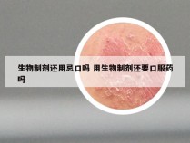 生物制剂还用忌口吗 用生物制剂还要口服药吗