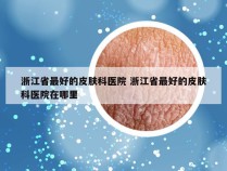 浙江省最好的皮肤科医院 浙江省最好的皮肤科医院在哪里