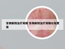 生物制剂治疗周期 生物制剂治疗周期以及费用