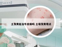 土发黄能治牛皮癣吗 土壤发黄霉点