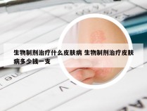 生物制剂治疗什么皮肤病 生物制剂治疗皮肤病多少钱一支