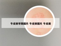 牛皮鲜早期图片 牛皮鲜图片 牛皮廨