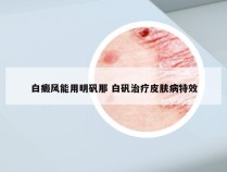 白癜风能用明矾那 白矾治疗皮肤病特效