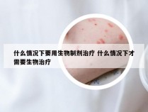 什么情况下要用生物制剂治疗 什么情况下才需要生物治疗