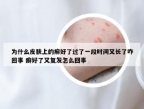 为什么皮肤上的癣好了过了一段时间又长了咋回事 癣好了又复发怎么回事