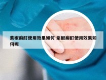 紫椒癣酊使用效果如何 紫椒癣酊使用效果如何呢