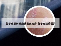 兔子皮肤长癣应该怎么治疗 兔子皮肤癣图片