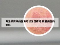 专治银屑病的医生可以治湿疹吗 银屑病医的好吗