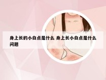 身上长的小白点是什么 身上长小白点是什么问题