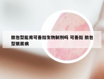 脓包型能用可善挺生物制剂吗 可善挺 脓包型银屑病