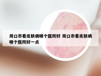 周口市看皮肤病哪个医院好 周口市看皮肤病哪个医院好一点