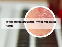 江苏省皮肤病研究所在哪 江苏省皮肤病研究所地址