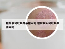 银屑病可以喝白茅根水吗 银屑病人可以喝牛蒡茶吗