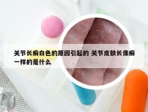 关节长癣白色的原因引起的 关节皮肤长像癣一样的是什么