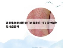 注射生物制剂后能打肉毒素吗 打了生物制剂能打疫苗吗