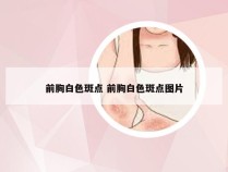 前胸白色斑点 前胸白色斑点图片