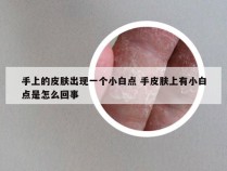 手上的皮肤出现一个小白点 手皮肤上有小白点是怎么回事