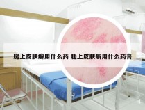 腿上皮肤癣用什么药 腿上皮肤癣用什么药膏