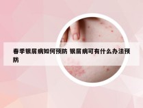 春季银屑病如何预防 银屑病可有什么办法预防