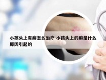 小孩头上有癣怎么治疗 小孩头上的癣是什么原因引起的