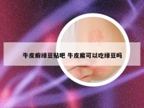 牛皮癣绿豆贴吧 牛皮廨可以吃绿豆吗